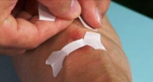 Koli-Bandi-ile-Kelebek-Bandaji-Yapmak