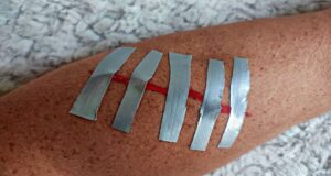 Koli Bandını Bandaj Olarak Kullanabilir misiniz? Koli-Bandini-Bandaj-Olarak-Kullanabilir-misiniz