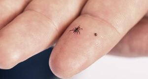 Kene-Gelmemesi-icin-Ne-Surulmektedir